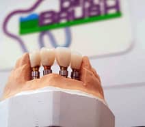 Slider image (6) Dental Brush Tijuana